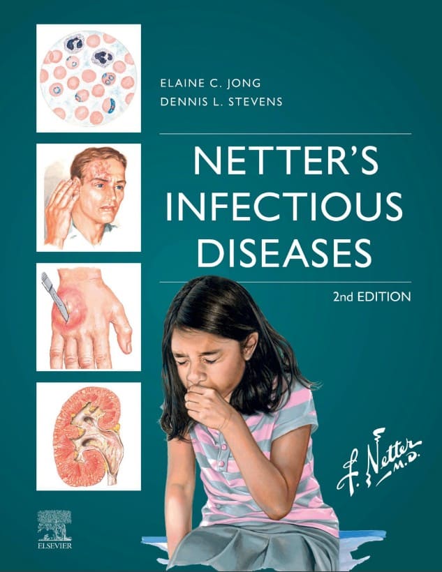 Netter's Infectious Diseases (2nd Ed.) by Elaine C. Jong and Dennis L. Stevens